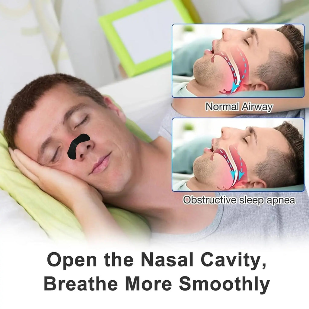 Anti Snoring Nose Strips for Breathing